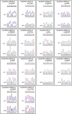 Functional Validation of CLDN Variants Identified in a Neural Tube Defect Cohort Demonstrates Their Contribution to Neural Tube Defects